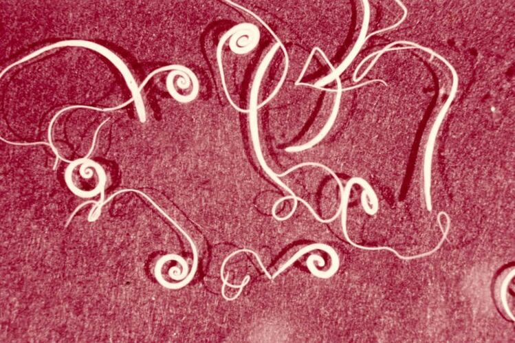 roundworms of the human body