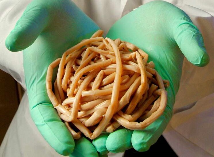 worms of the human body