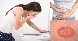 parasitic symptoms in the body
