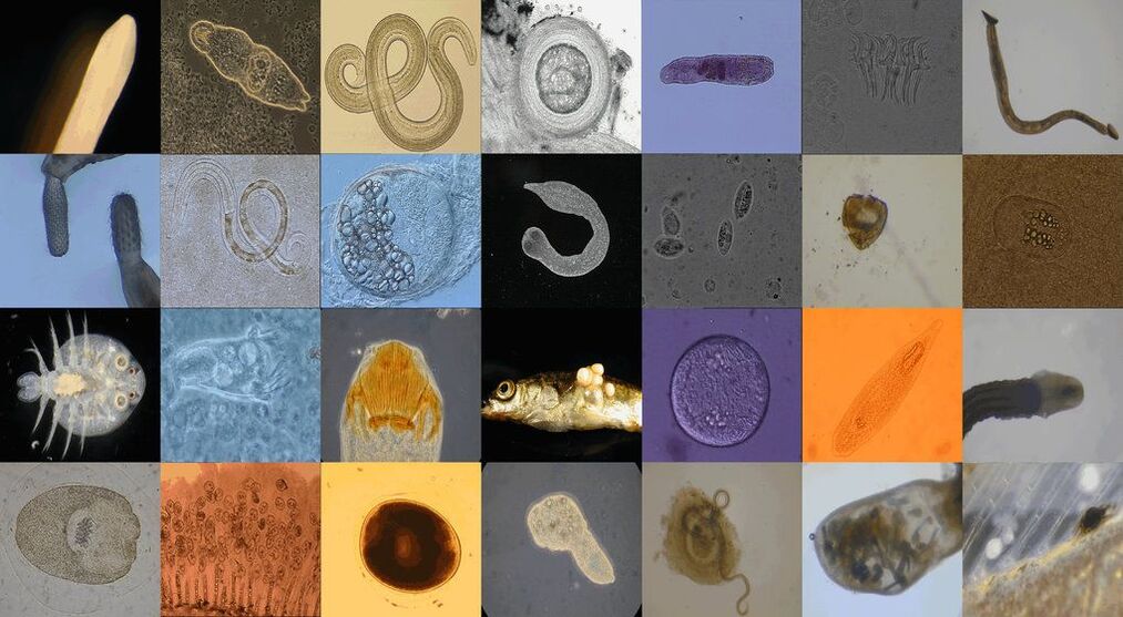 types of intestinal parasites