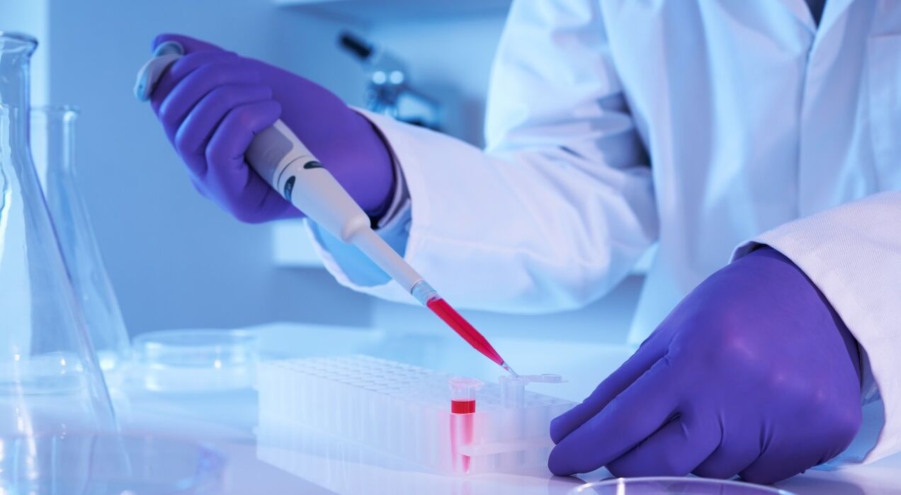 How to take parasitic analysis