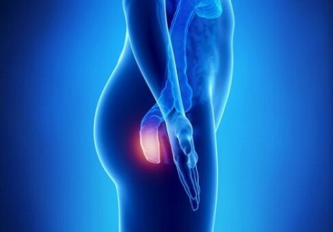 itching in the rectum as an indication for parasite testing